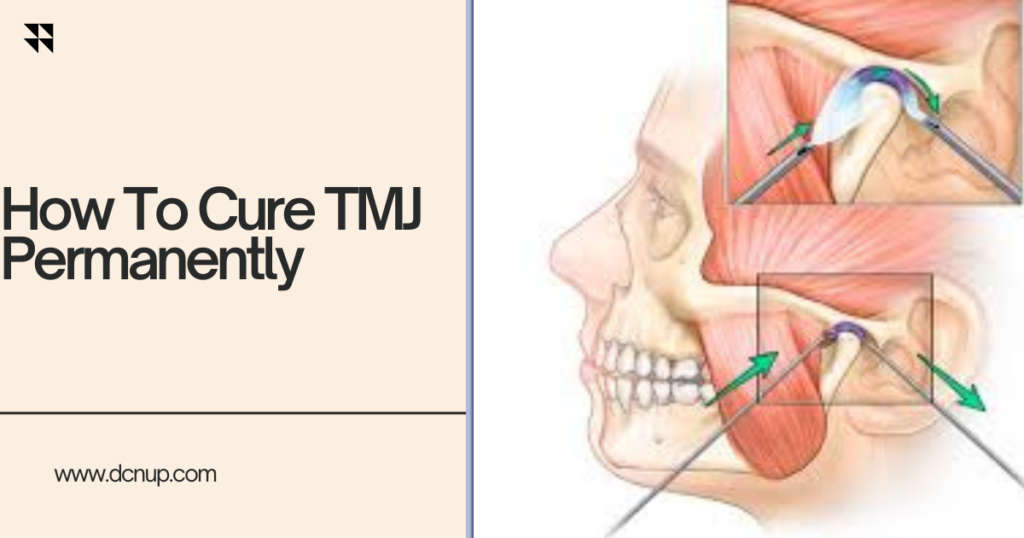 How To Cure TMJ Permanently